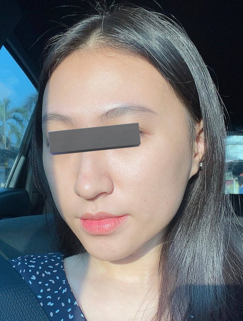 #SkincareIDNTips Skin Barrier rusak jadi mengelupas, kering, kemerahan, perih, dan gatel. Balikin normalnya gimana? Fokus pake 3 Step Skincare aja sampe sembuh ‧₊˚ 𝙂𝙚𝙣𝙩𝙡𝙚 𝙁𝙖𝙘𝙚 𝙒𝙖𝙨𝙝 ~ 𝙈𝙤𝙞𝙨𝙩𝙪𝙧𝙞𝙯𝙚𝙧 𝙎𝙠𝙞𝙣 𝘽𝙖𝙧𝙧𝙞𝙚𝙧 ~ 𝙎𝙪𝙣𝙨𝙘𝙧𝙚𝙚𝙣 ₊˚