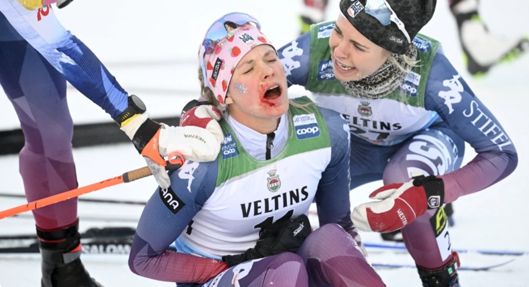 Jessie Diggins' absolutely wild comeback to a second place world cup finish with a bloody face, one glove, and a borrowed pole is instant legend — if Americans cared about xc skiing she'd be on every cereal box in the country