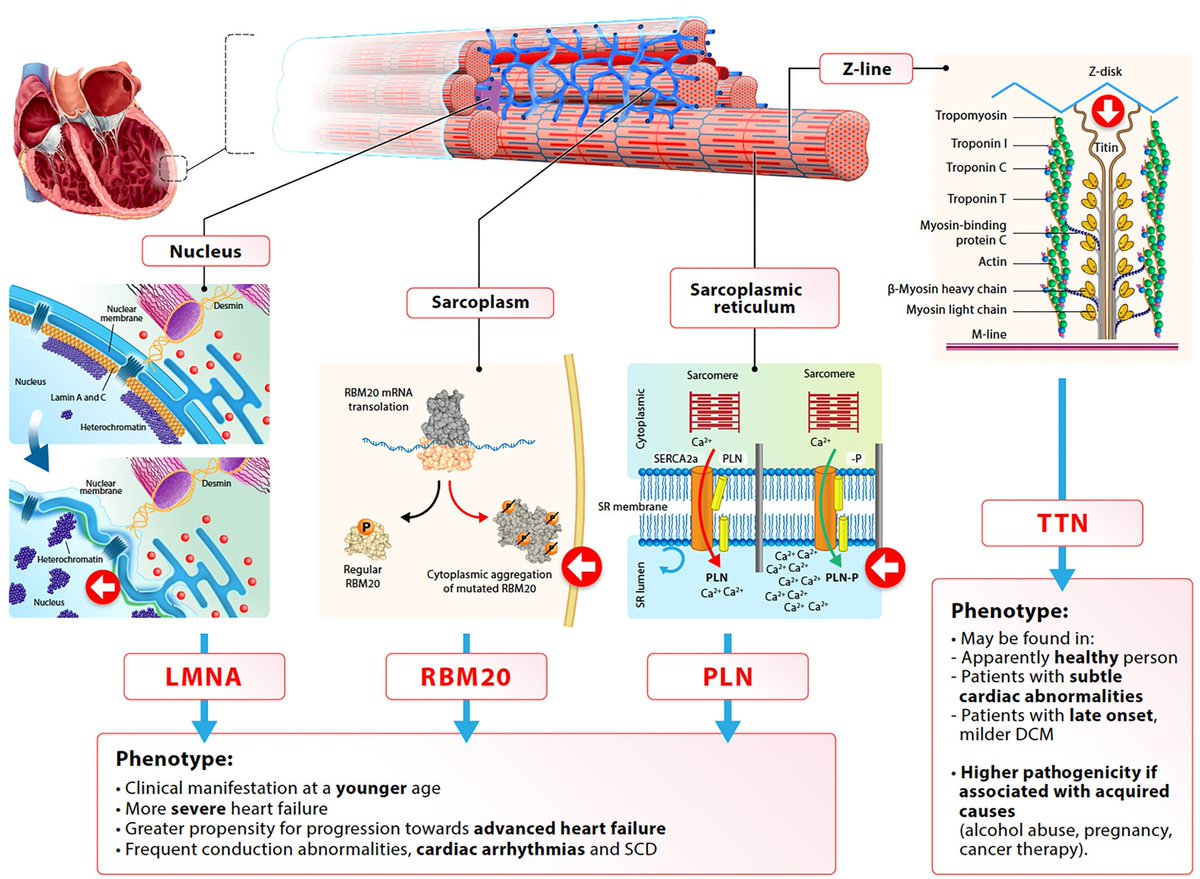 State-of-the-art document on optimal contemporary management of cardiomyopathies #2023review 

onlinelibrary.wiley.com/doi/10.1002/ej…
#CardioTwitter #Cardioed #cardiology