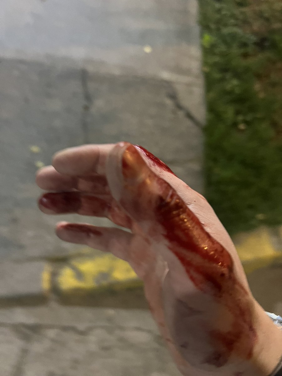 La pasé mal. La madrugada  de ayer un conductor de <a href="/Cabify_Chile/">Cabify Chile</a> me agredió cuando le pedí detenerse y dejarme, porque me llevaba a otro lado de mi casa. Me pegó con combos y patadas en el rostro. La mano ensangrentada es por los cortes que tengo en la cara