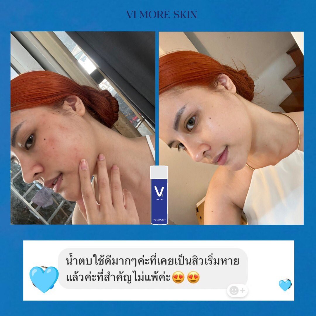 vimoreskin tweet picture