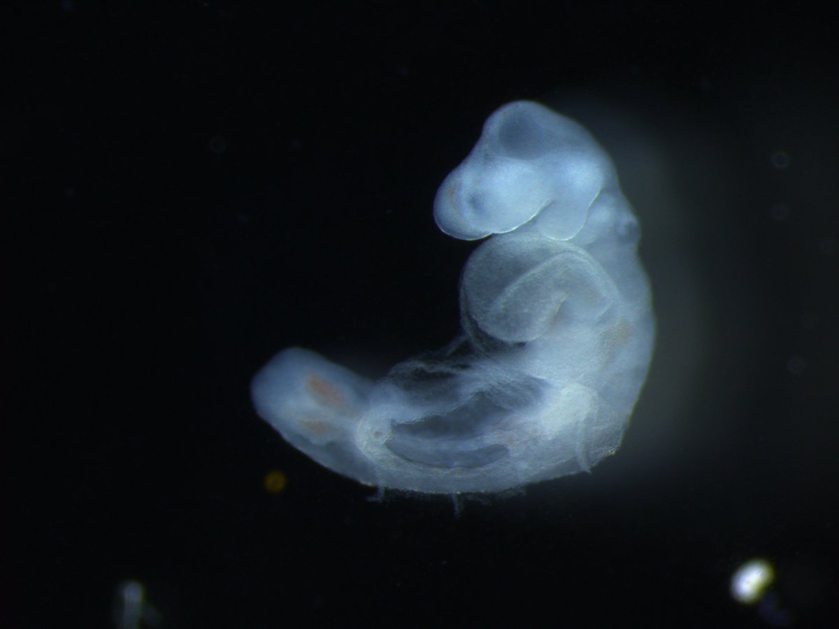 Today's #GeneOfTheDay is #Nog. Human diseases associated include Proximal symphalangism-1A. Mice with Nog inactivated exhibit abnormal neural tube morphology, abnormal bone structure, and increased circulating alkaline phosphatase level. More data here: bit.ly/NogGene