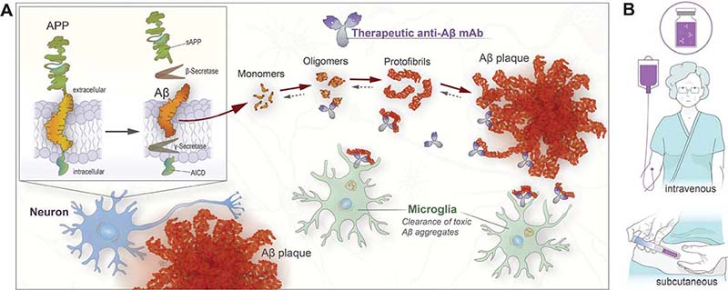 Immunotherapy presents a promising treatment option for Alzheimer’s disease, and there are several loci at which immunotherapies targeting Alzheimer’s disease could exert their effects. ujms.net/index.php/ujms…