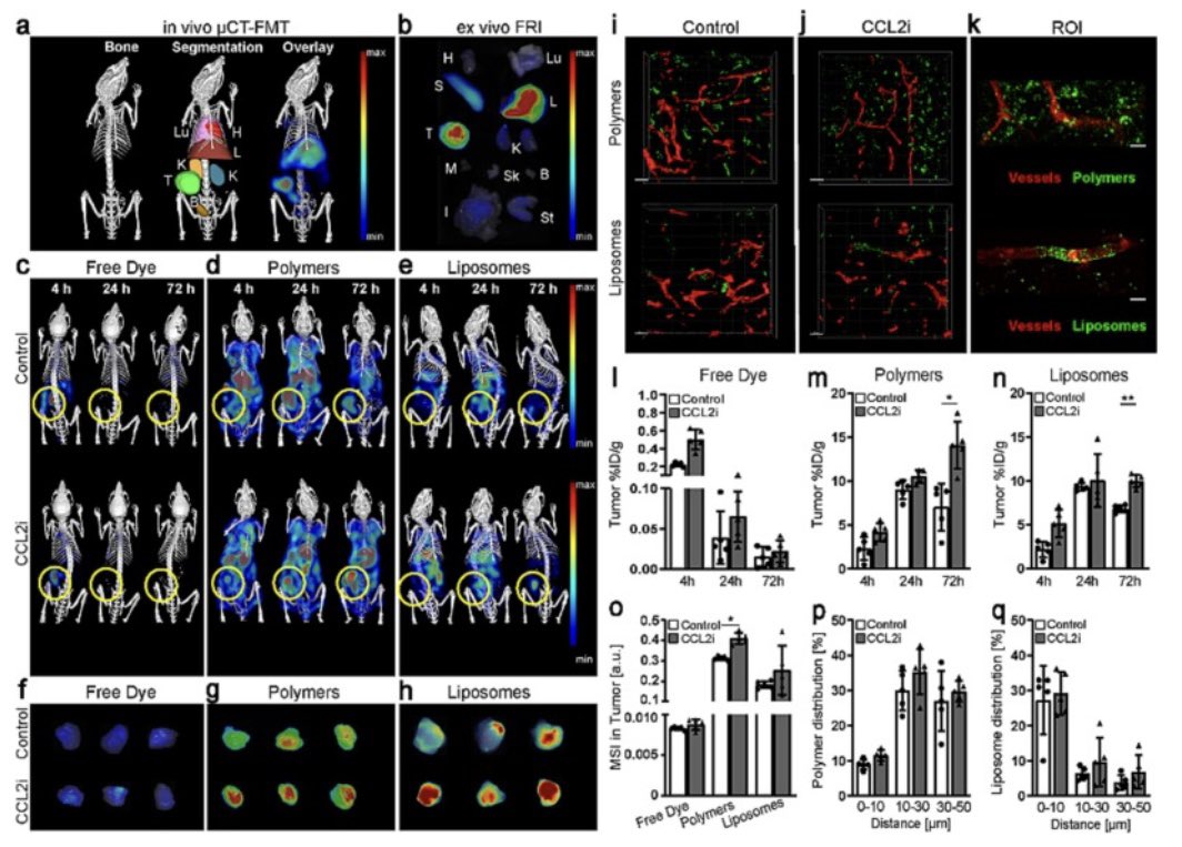 Twan Lammers (@twan_lammers) on Twitter photo Anti-CCL2 RNA treatment primes tumors for improved nanomedicine delivery. Great work by Diana Moeckel in <a href="/JCRnEDITORS/">J Controlled Release</a>. Many thanks to our friends at <a href="/Tacke_lab/">Tacke Lab</a> and <a href="/IMC_Prague/">Institute of Macromolecular Chemistry CAS</a> for multiple years of close collaboration👌 Anti-CCL2 RNA treatment primes tumors for improved nanomedicine delivery. Great work by Diana Moeckel in <a href="/JCRnEDITORS/">J Controlled Release</a>. Many thanks to our friends at <a href="/Tacke_lab/">Tacke Lab</a> and <a href="/IMC_Prague/">Institute of Macromolecular Chemistry CAS</a> for multiple years of close collaboration👌
