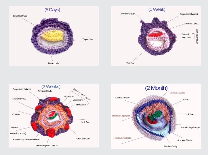 the Node (@the_node) on Twitter photo Crocheted embryo models — featured artwork from the Node-BSDB virtual art exhibition
We caught up with Tahani Baakdhah <a href="/Thepurplelilac/">Dr. Tahani Baakdhah د. تهاني باعكضه</a> to learn more about her research and the story behind creating the crocheted embryo models:
thenode.biologists.com/crocheted-embr… Crocheted embryo models — featured artwork from the Node-BSDB virtual art exhibition
We caught up with Tahani Baakdhah <a href="/Thepurplelilac/">Dr. Tahani Baakdhah د. تهاني باعكضه</a> to learn more about her research and the story behind creating the crocheted embryo models:
thenode.biologists.com/crocheted-embr…