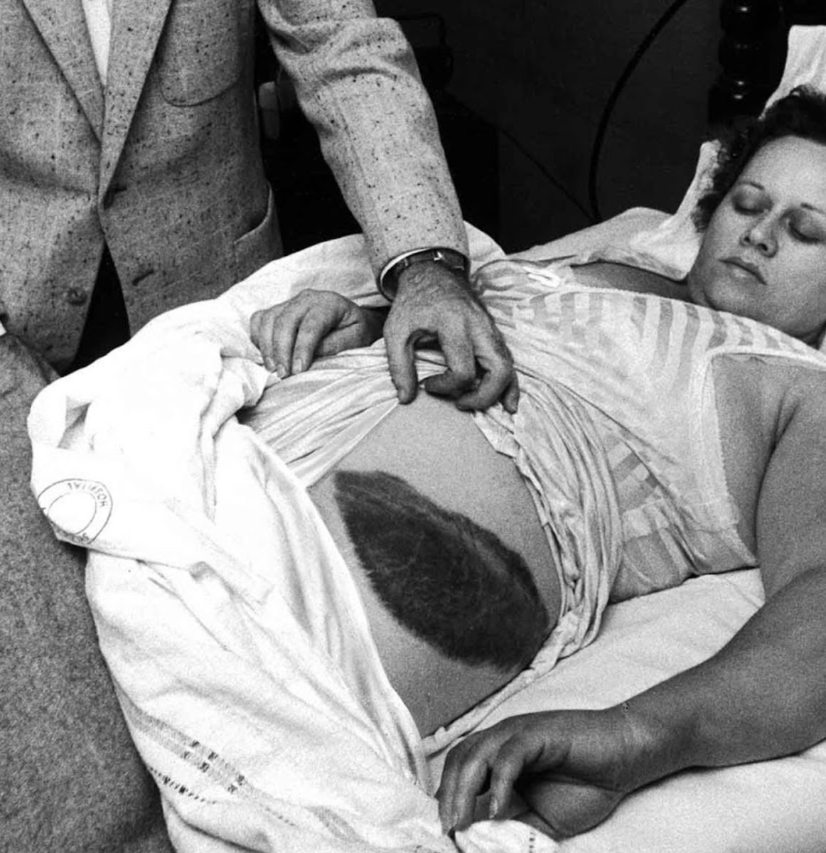 depthsofwiki's tweet photo. On this day in 1954, a meteorite landed on a 34-year-old woman in Alabama who was taking a nap (she got a big bruise but was ultimately fine) https://t.co/wdhoN1iKgb