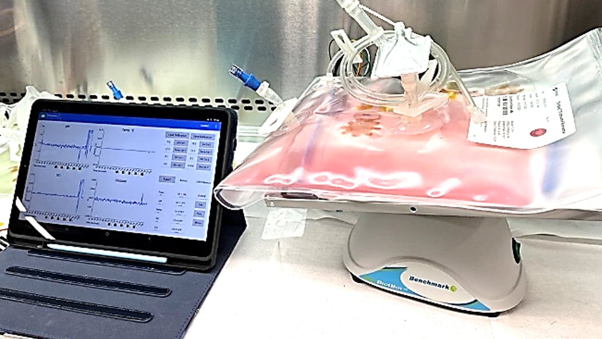 Yeo Research Group (@gt_hongyeo) on Twitter photo Exciting news! Our research group has secured $700,000 in funding from @RENOLITGroup to develop a multi-sensing platform for continuously monitoring cell culture parameters. We're grateful for the support of <a href="/CMaT_ERC/">Cell Manufacturing Technologies</a>, <a href="/MEGeorgiaTech/">Georgia Tech ME</a>, @IEN_GATech, and <a href="/ibbgatech/">Institute for Bioengineering and Bioscience @ GT</a>. Exciting news! Our research group has secured $700,000 in funding from @RENOLITGroup to develop a multi-sensing platform for continuously monitoring cell culture parameters. We're grateful for the support of <a href="/CMaT_ERC/">Cell Manufacturing Technologies</a>, <a href="/MEGeorgiaTech/">Georgia Tech ME</a>, @IEN_GATech, and <a href="/ibbgatech/">Institute for Bioengineering and Bioscience @ GT</a>.