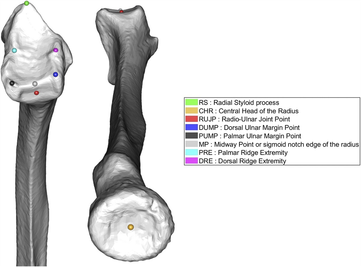 CHUdeNice's tweet photo. #Research on #orthopedics
📰"An Evaluation of the Reliability of Manual Landmark Identification on 3D Segmented Wrists"
by Rémy Winter and Dr @Marcoliviernice from #CHUdeNice.
#radius #landmarking #reproducibility
https://t.co/KnHRPXRzYp https://t.co/en58EYuf4f