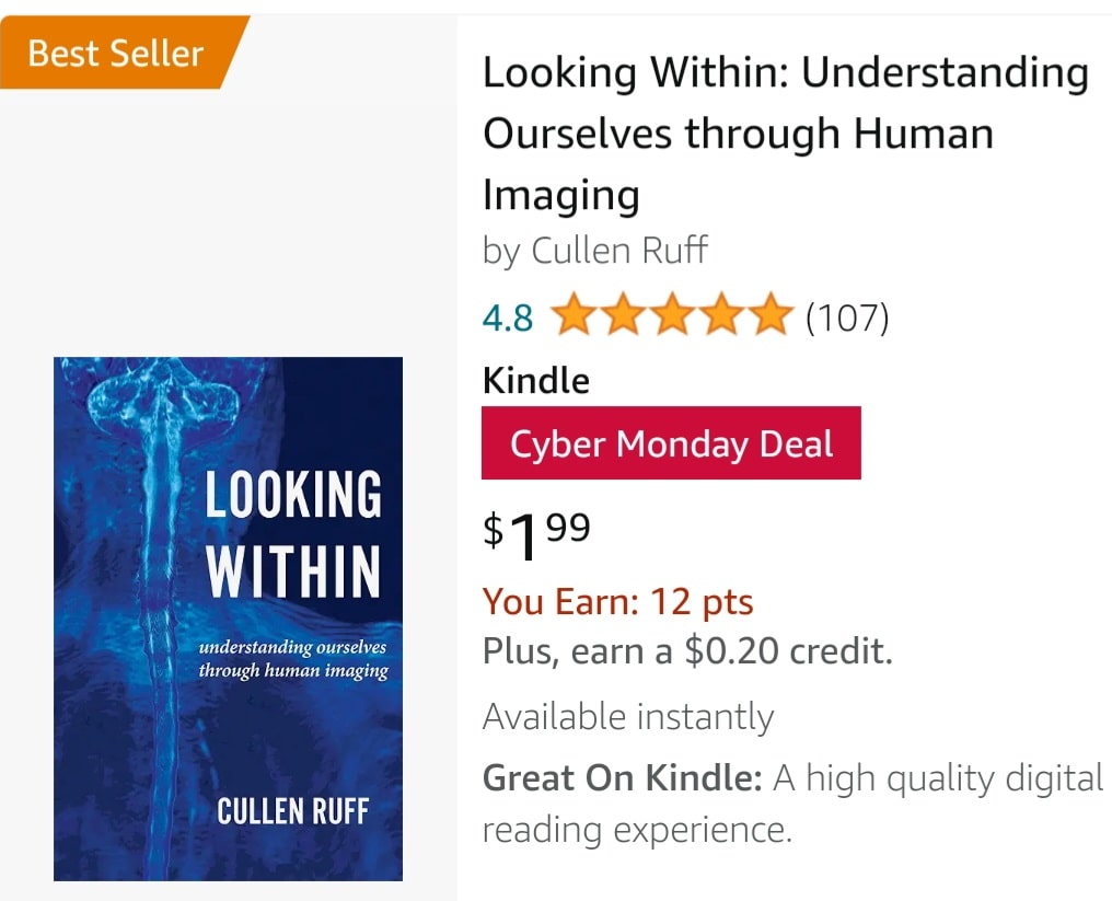 CullenRuff's tweet photo. #bestselling #radiology #ebook #Promotion until Dec. 1st #RSNA2023 #RSNA23 #RSNA https://t.co/RJxETskLOt https://t.co/4KvYfQ6iH7