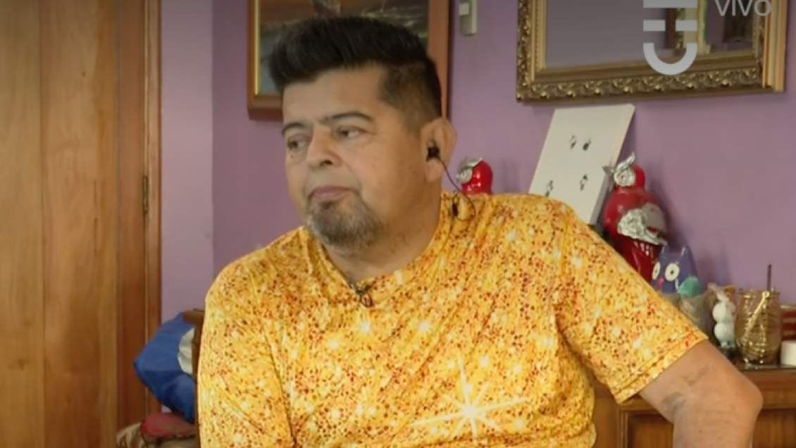 Cooperativa's tweet photo. Mauricio "El Indio" Medina sufrió amputación de su pierna: "Ha sido un trauma" #CooperativaContigo https://t.co/7AP7BBFOs8 https://t.co/Aps21pB0tu