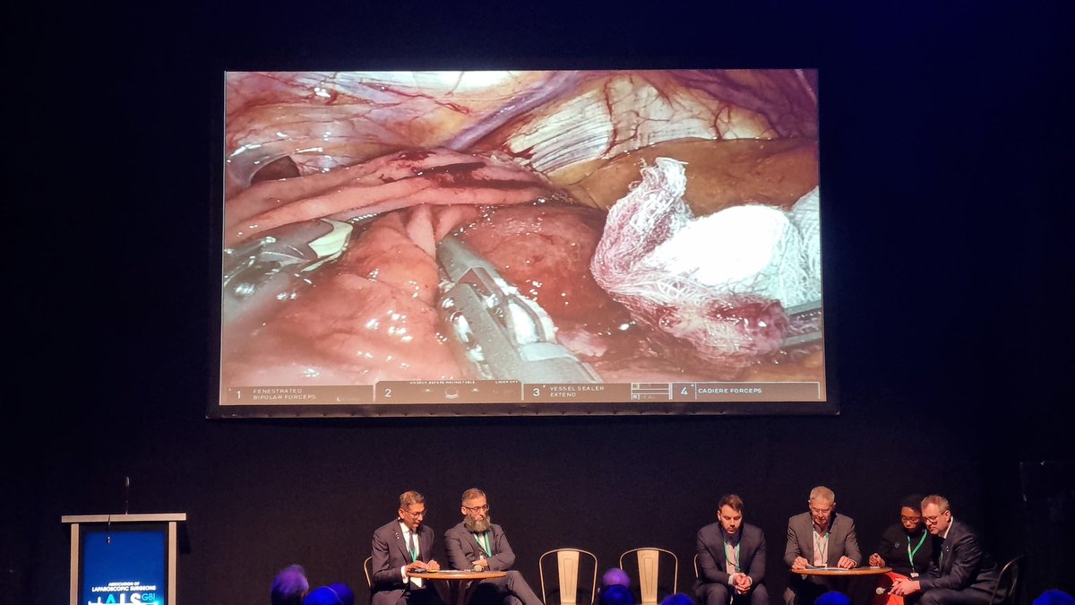 ALRSGBandI's tweet photo. Live stream of Robotic GIST resection in Main Stage of Main Auditorium at #ALS2023
Please use #ALS2023 for any questions to the esteemed panel. https://t.co/63xl7imLcE