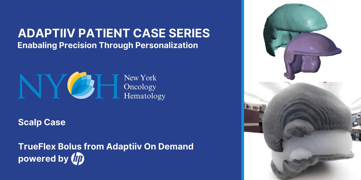 Dr. Justin Juliano at New York Oncology provides insight into a recent scalp case he did and why he chose Adaptiiv On Demand. Click here to hear about his experience in his own words.
lnkd.in/gmuseMSE
#radiationoncology #newyorkoncology #adaptiivondemand