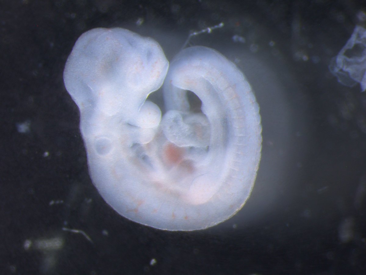 Today's #GeneOfTheDay is #Faf2. Human diseases predicted to be associated include Nanophthalmos. Mice with Faf2 inactivated exhibit several abnormalities in embryo and behavioral/neurological phenotypes, including abnormal midbrain development. More data: bit.ly/Faf2Gene