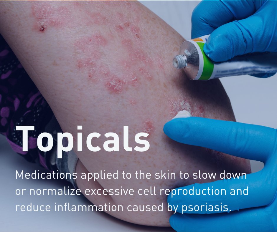 Topical treatments – medications applied to the skin – typically are your first line of defense when treating psoriasis. Head to our website for your guide to topical treatments. ow.ly/bC1250Q8tfH