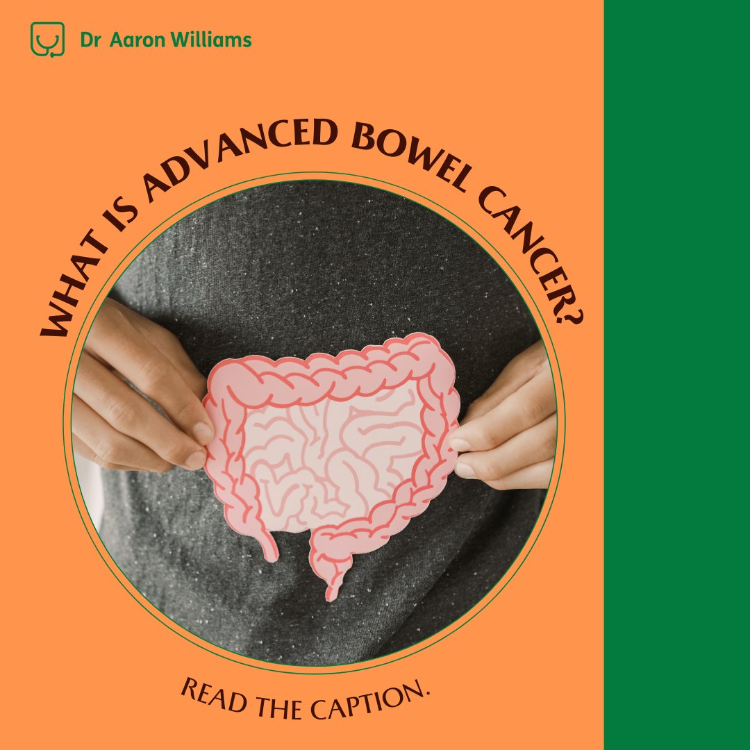 draaronwilliams's tweet photo. Advanced bowel cancer is cancer that has spread from the back passage (rectum) and large intestines (colon) to other parts of the body, such as the liver.

The symptoms of advanced bowel cancer can include tiredness, loss of appetite, and low energy.

#bowelcancer #coloncancer https://t.co/XbTc1dnmip