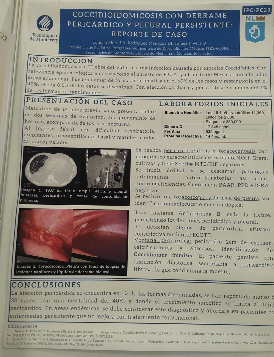 lindsayconcha's tweet photo. This year wey are proud of our work, the best team of PGY-3 and 4 Peds Residents at @emcs_tecdemty
1. GIS in Rickettsial cases
2. Pleural coccidioidomycosis
3. Septic Arthitis due to respiratory pathogens
4. Twins with Parechovirus meningitis
#IDTwitter #FuturePID #ID https://t.co/8TGYH0eJCS