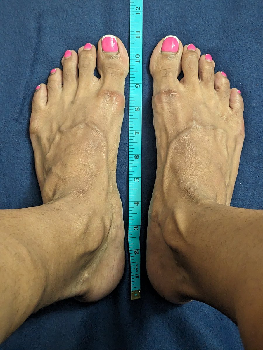 bigfeetlover253's tweet photo. Huge 11 inchers of @prettymuscle12
#BigFeetGirls #HugeFeet #FeetCompared #FootComparison #FeetComparison #FeetMeasured #FootMeasurement https://t.co/bMgaQzkLXi