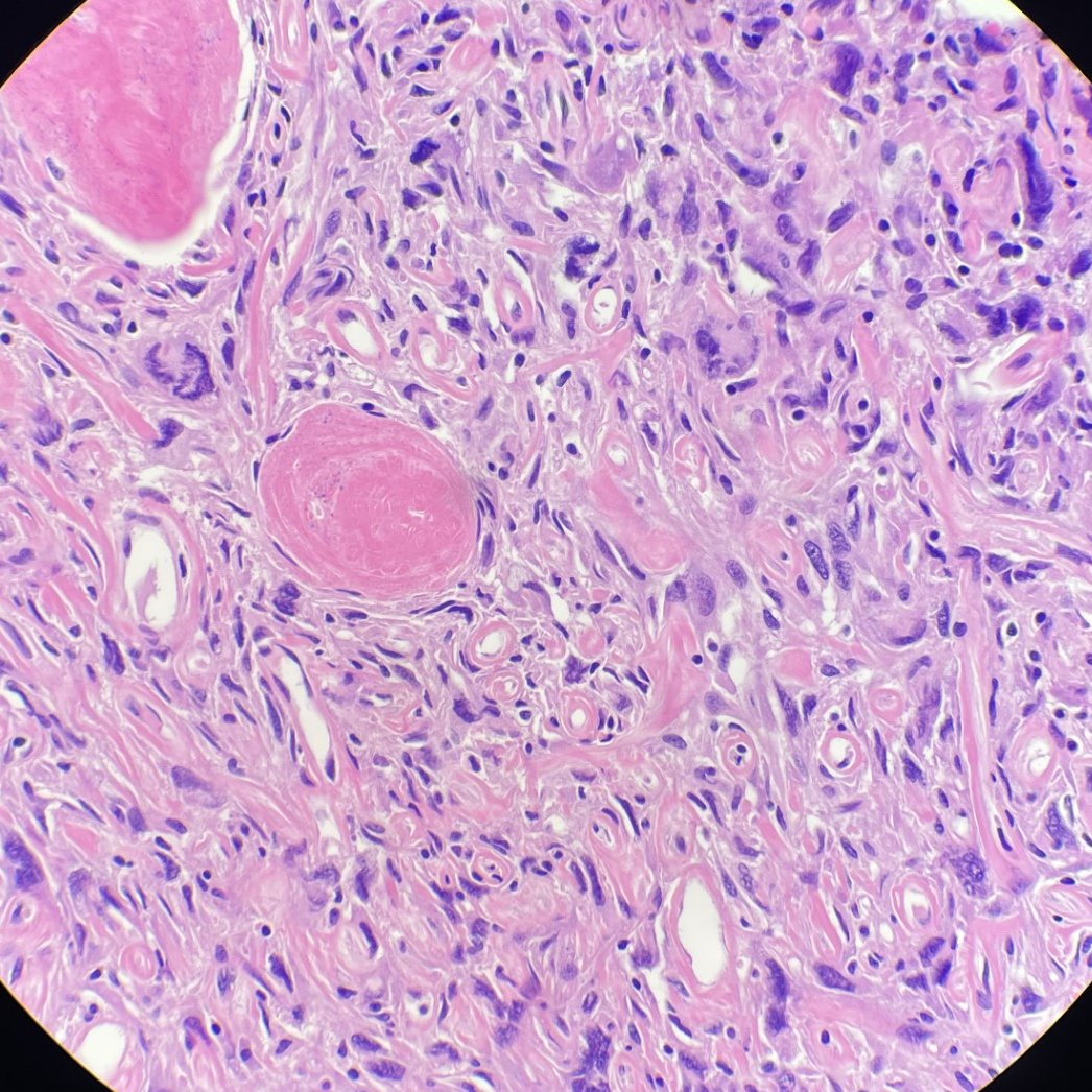 megothelioma tweet picture