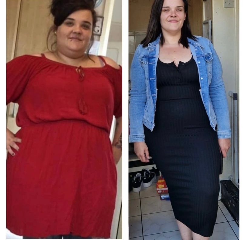 REPOST @ellagotsleeved #BeforeAndAfter Inspirational Ella, over 20 stone lost! 🤯🤩 We are so proud of you 💫 Get in touch to start your weight loss journey with Tonic today, our team are here for you 😊⁠