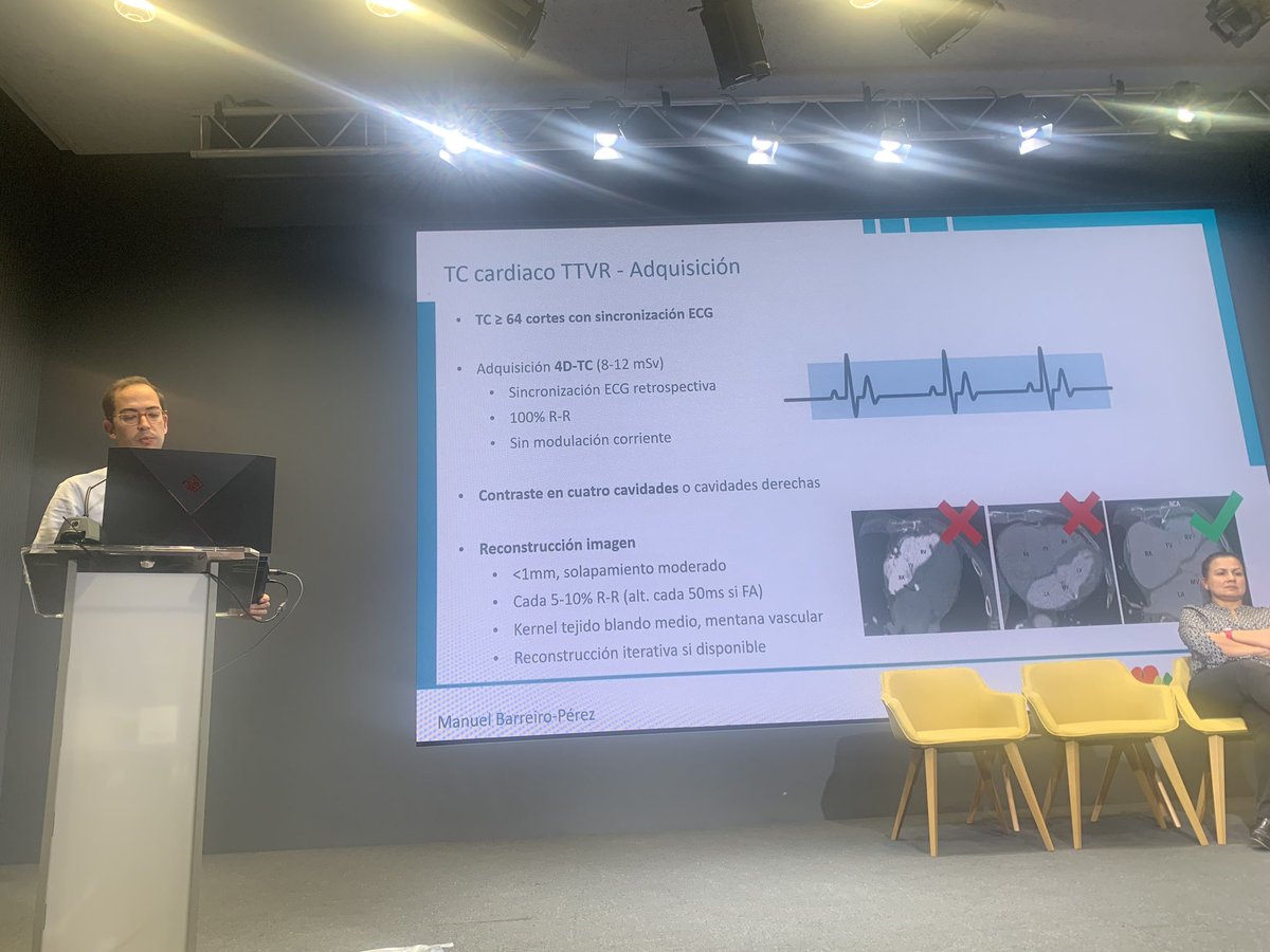 Tras una tarde interesante con sesiones sobre coartación aórtica de @CardiologiaLa y de válvula aórtica del hospital la Princesa😀 Gran broche final con la sesión de tricúspide de @Cardiologiavigo . GRACIAS‼️