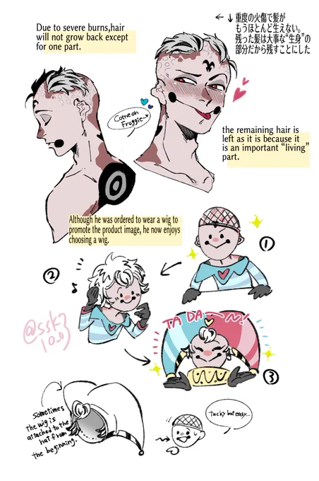 "When he took off his hat"human fizz idea(※I have added a little depiction of the burn scar to make it easier to understand.)(※※ Like the original, the burn scars are colored in a light color.I would be happy if you could enjoy it as a part of character design!) 