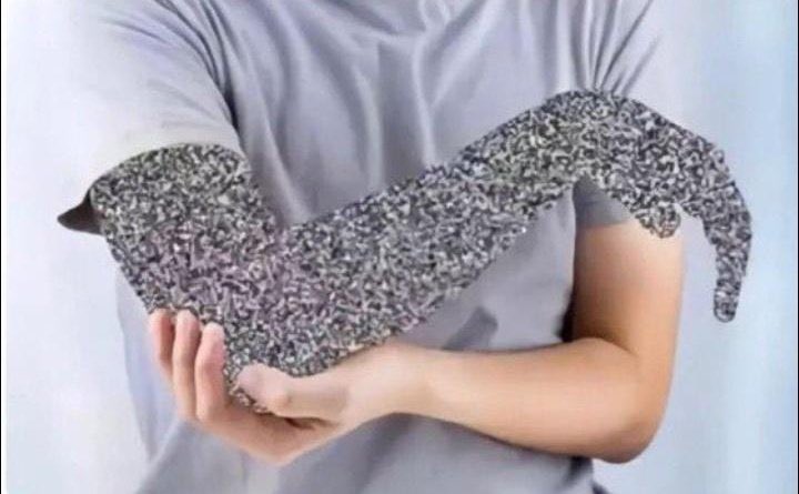 *me doy en el codo*
mi brazo: