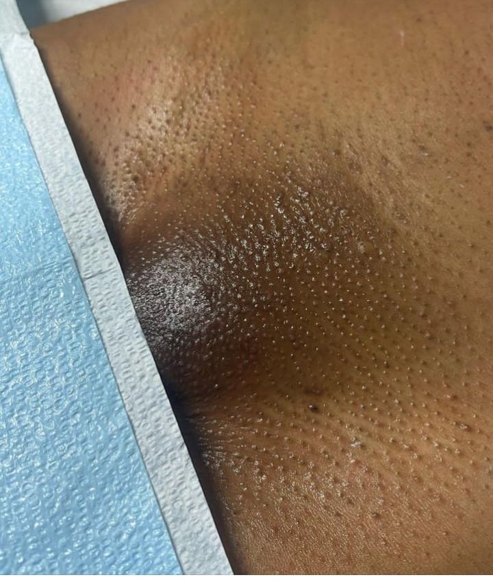 waxonly0's tweet photo. Team smooth or  team cactus which one are you ? 

Book for your waxing appointments with us to join team smooth!!!!!!!❤

0974029936 https://t.co/p9bQezfQov