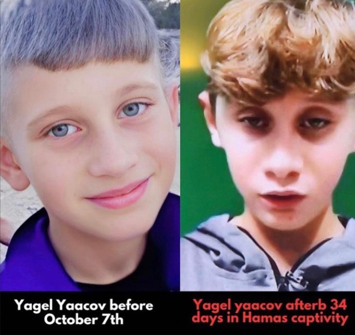 🚨🚨BREAKING: FIRST REPORT OF HAMAS HOSTAGE TORTURE | ISRAELI CHILREN TESTIMONY

Reporting in a closed door testimony, Israeli journalists recount freed Israeli children, Or (16) and Yigal (12) Yaacov, saying they were drugged by Hamas, and were tortured by having red-hot exhaust