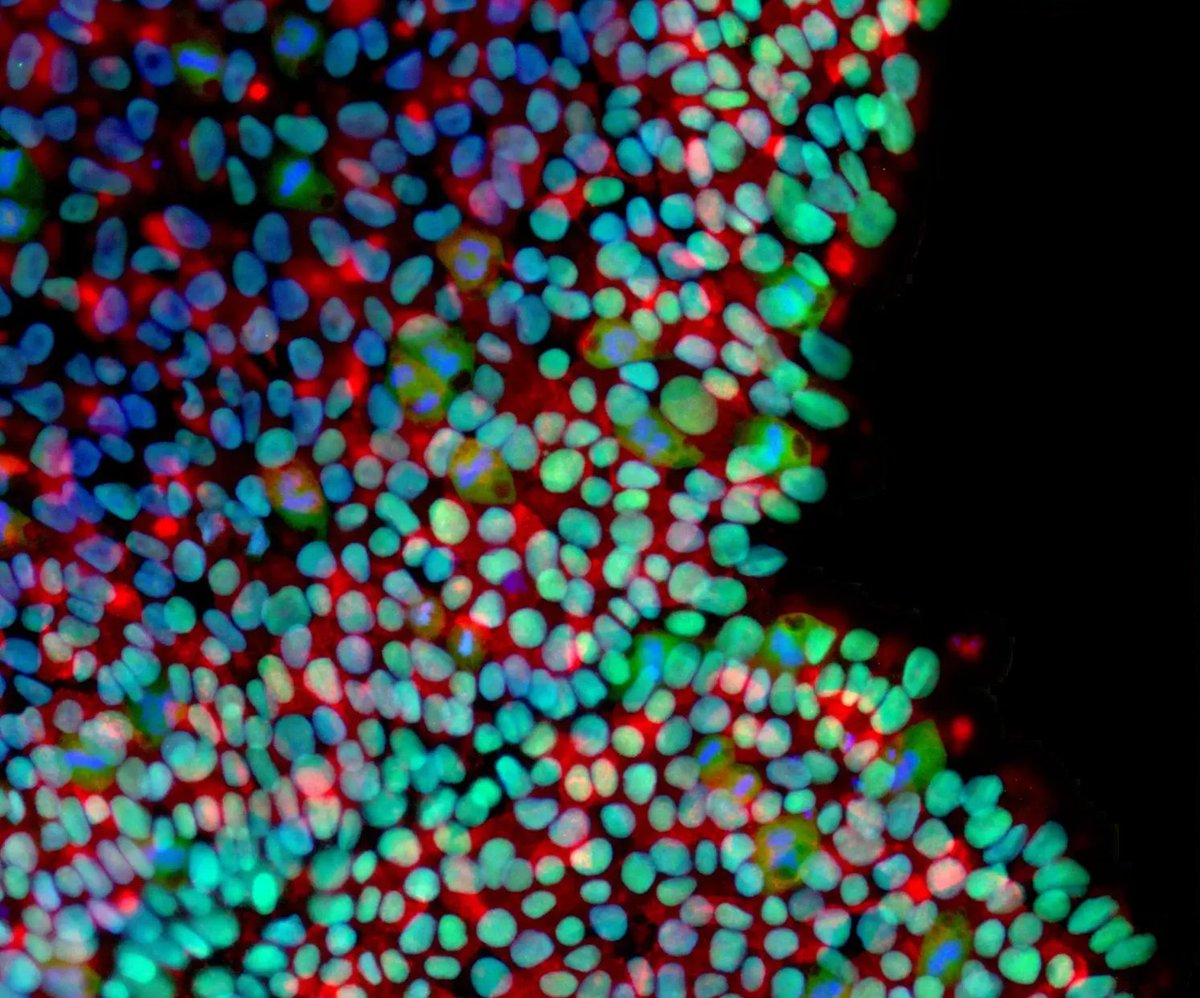 CellectedLTD's tweet photo. RIQUEST operates in two meticulous stages. First, a swift genomic check, followed by comprehensive cell quality assessment. It ensures top-notch standards for your iPSCs. #RIQUEST #RapidQC #iPSC https://t.co/KdSUQdTuej
1/ https://t.co/JzrM87TGZJ