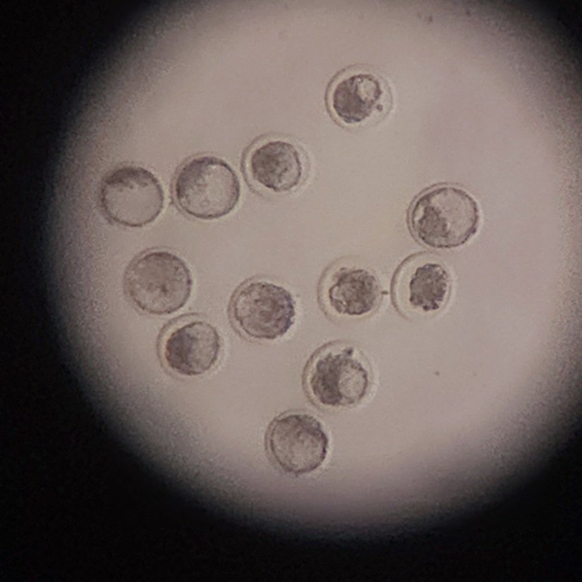 dairemarkham's tweet image. Nice collection today for fresh transfer 👌#embryotransfer