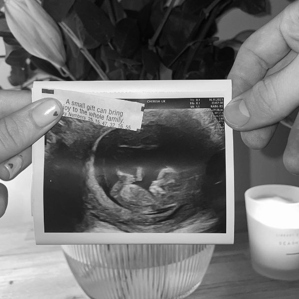 Official_STFC's tweet photo. Congratulations to #STFC midfielder, Liam Kinsella and his partner Ellie Grigg on their announcement that they are expecting their first child ❤️ https://t.co/1XXs7HwvWU