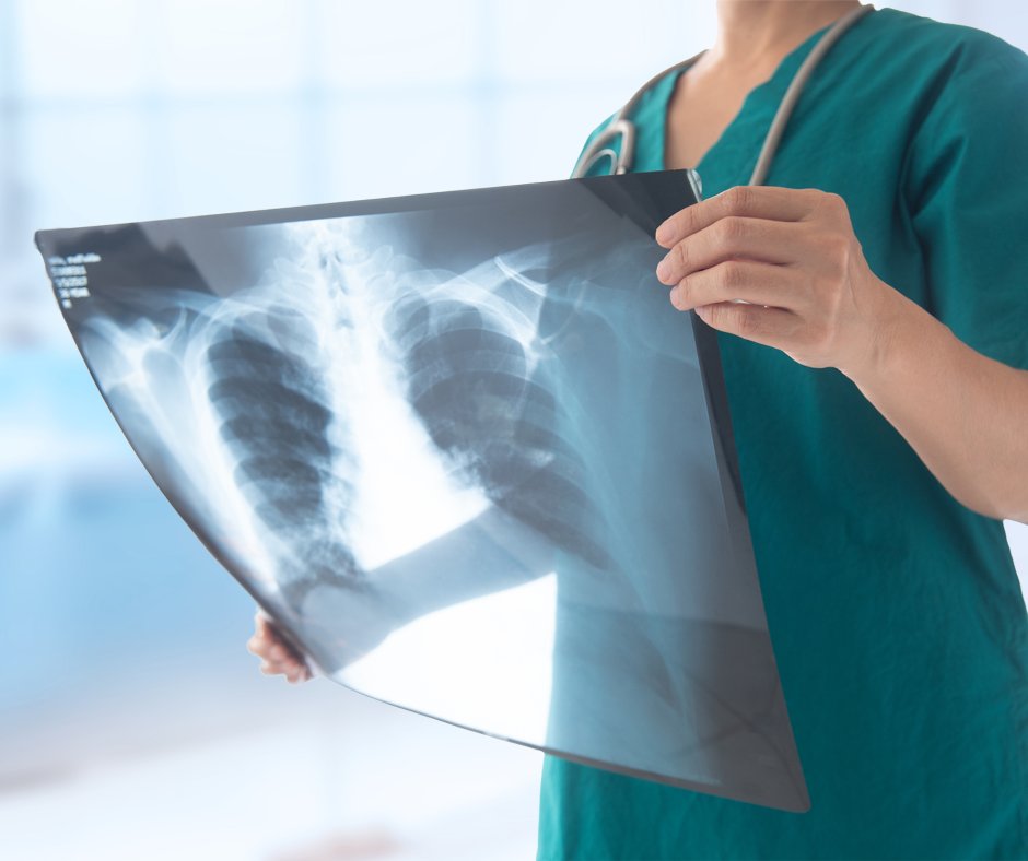Radon is a radioactive gas that damages the tissue in your lungs. Over time that damaged lung tissue may mutate and develop into lung cancer. After smoking, radon is the second leading cause of lung cancer.

Test your home. Mitigate problems. Breathe safely.