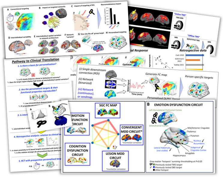 Robin Cash (@cashmachine15) on Twitter photo 🧠⚡️To personalize or not to personalize? That is the question...
...that we address in our latest review <a href="/BiologicalPsyc1/">Biological Psychiatry</a> with <a href="/AndrewZalesky/">Andrew Zalesky</a>🥳
Open access: biologicalpsychiatryjournal.com/article/S0006-…
We examine (& illustrate)
the rationale, latest evidence, controversies & opportunities🧐 🧠⚡️To personalize or not to personalize? That is the question...
...that we address in our latest review <a href="/BiologicalPsyc1/">Biological Psychiatry</a> with <a href="/AndrewZalesky/">Andrew Zalesky</a>🥳
Open access: biologicalpsychiatryjournal.com/article/S0006-…
We examine (& illustrate)
the rationale, latest evidence, controversies & opportunities🧐