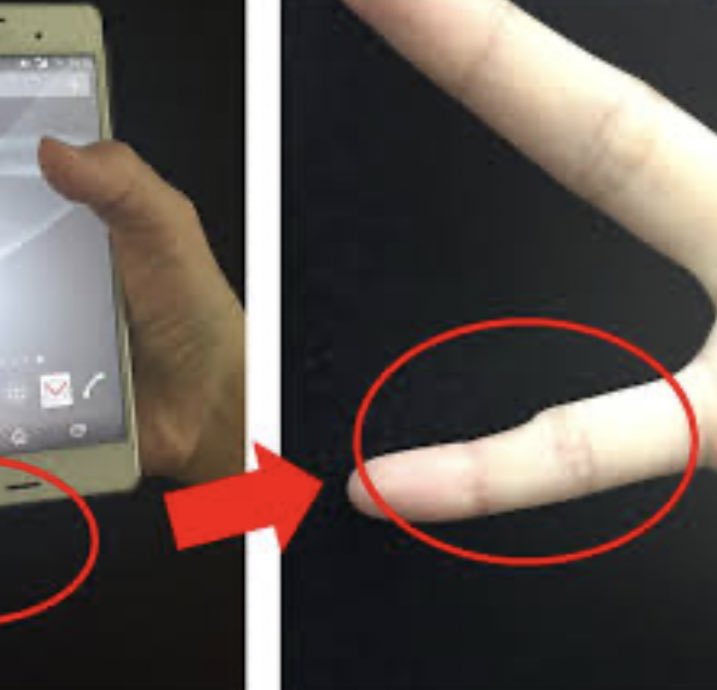 Después de ver ese documental sobre la deformación en el dedito de aguantar el teléfono,y ver qué millones de personas lo tenían ya ,incluyéndome ,ya me quedo traumita y siempre estoy agarrando el cell de otra manera.