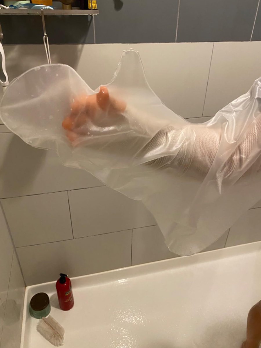 VivianW72375452's tweet image. ⁉ What Makes It The Best--Cryopush&apos;s Waterproof Cast Cover &amp;amp; Bandage Protector

#WaterproofProtection #BandageProtector #CryopushTechnology #waterproofcastcover #woundcare #woundprotector #waterproofing #castcover #bandagecover