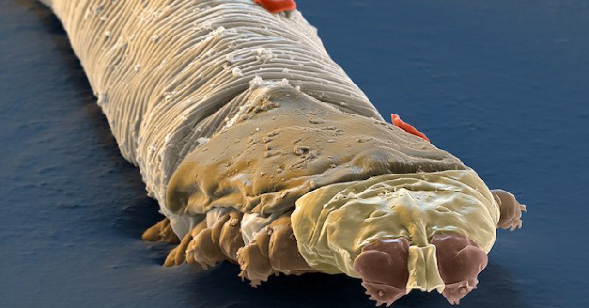 Did you know you have mites on your face called demodex? They're basically tiny spiders you pick up as you age and by age 60, you’ve got a couple of thousand of them living on your face. 😮 wb.md/47zQt9w