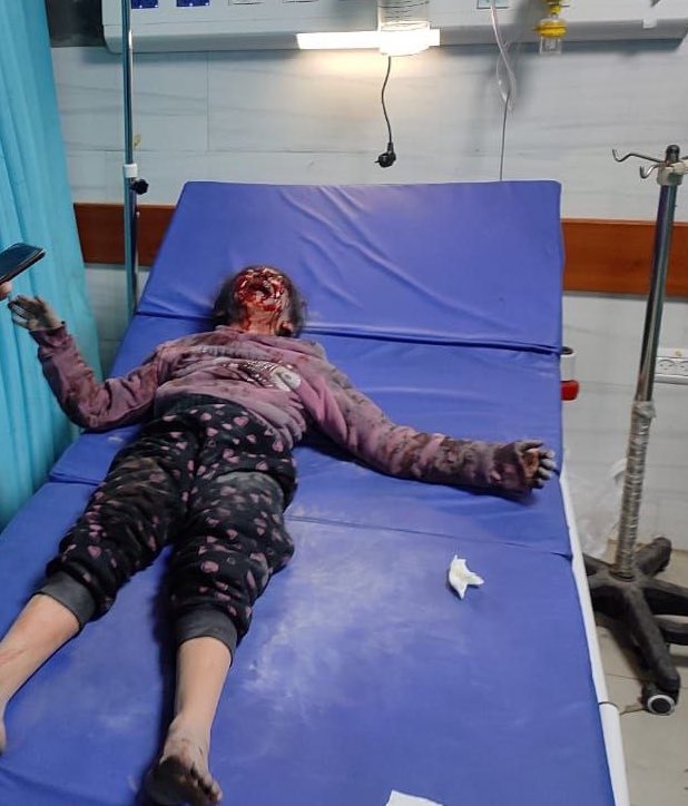 طفلة كانت هدفاً لقصف الاحتلال الإسرائيلي قبل قليل في قطاع غزة