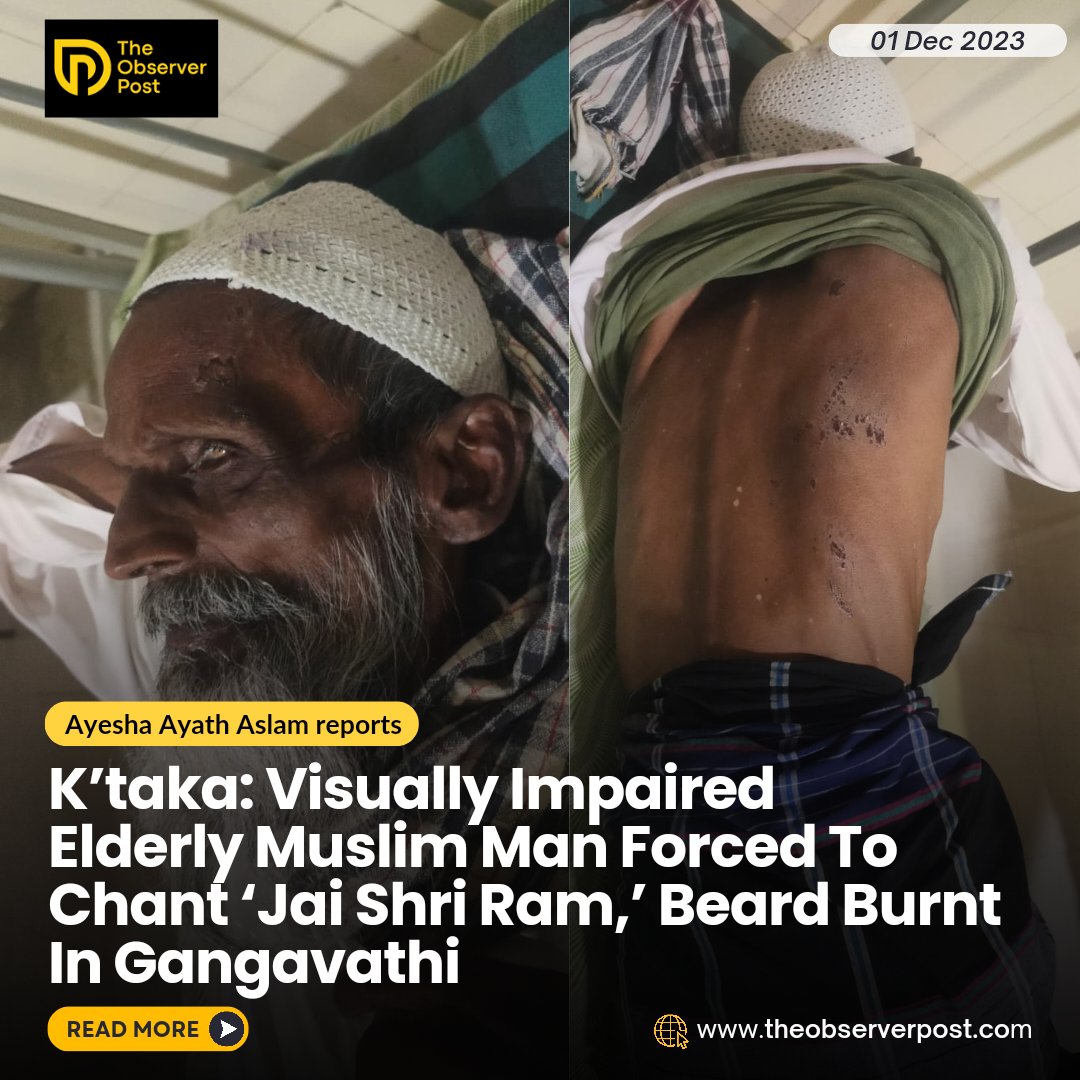 meerfaisal001's tweet photo. Visually Impaired Elderly Muslim Man Forced To Chant ‘Jai Shri Ram,’ Beard Burnt In Gangavathi, Karnataka.

Saab was allegedly kidnapped by miscreants who took him to an isolated place in Siddikere. They assaulted him, pushed him to the ground, and dragged him by his legs which caused severe injuries to his back. One of the miscreants attempted to chop his beard using a broken glass bottle. On failing, they lit a match stick and burnt his beard. As he cried out in agony, they responded with Islamophobic slurs and comments.

“They took me… cut my beard, burnt my beard, and assaulted me. They hit me on my chest,” Saab told @TheObserverPost.

https://t.co/W31L09YtGA