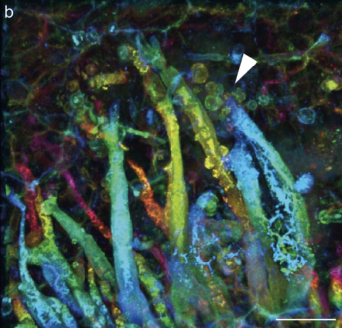 Alan R. T. Spencer (@alanrtspencer) on Twitter photo Interested in ancient fossil fungi, plant pathogens, the Rhynie cherts, and Beatrix Potter...? Look no further! New paper out in Nature Comms:  rdcu.be/dsv6l Interested in ancient fossil fungi, plant pathogens, the Rhynie cherts, and Beatrix Potter...? Look no further! New paper out in Nature Comms:  rdcu.be/dsv6l