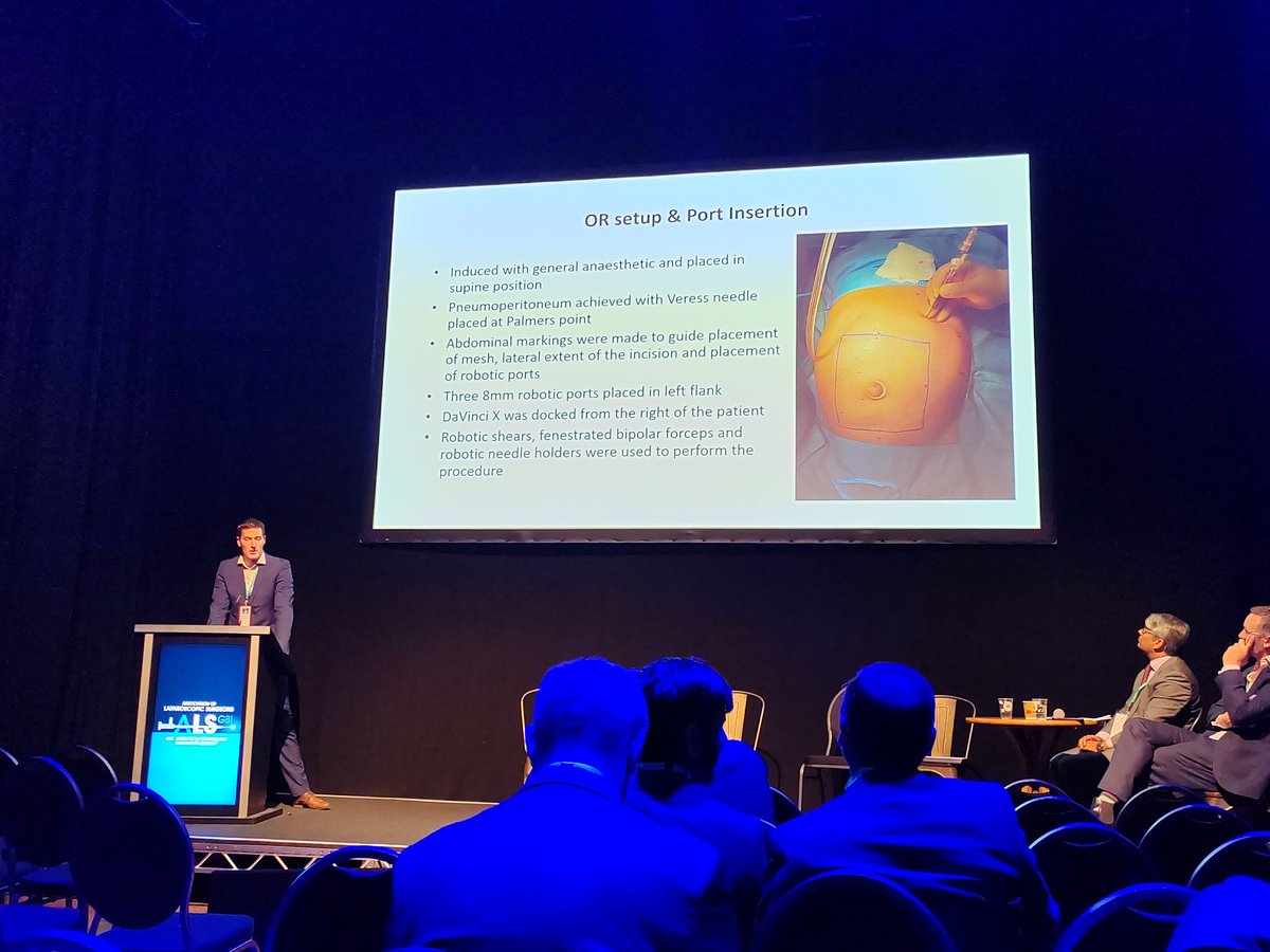 DerbyPBunit's tweet image. Delighted to see our trainee @BrazkiewiczM (CT1 Gen Surg East Midlands) present our experience of r-TARUP for ventral hernias.

Excellent talk and responses to the  Q&amp;amp;A session. Well done 👏🏽

#FOAMed #MedEd #ASM2023