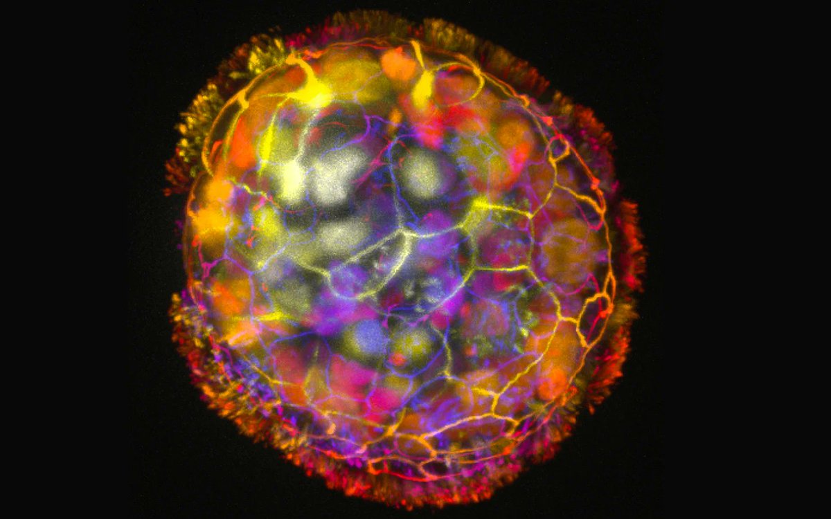 EruditeLuminary's tweet image. Scientists have successfully created tiny living #robots using human cells, which have the potential to heal damaged tissue & wounds. Referred to as "#anthrobots," these creations were developed by a team of students from #HarvardUniversity's Wyss Institute & Tufts University.
🧵