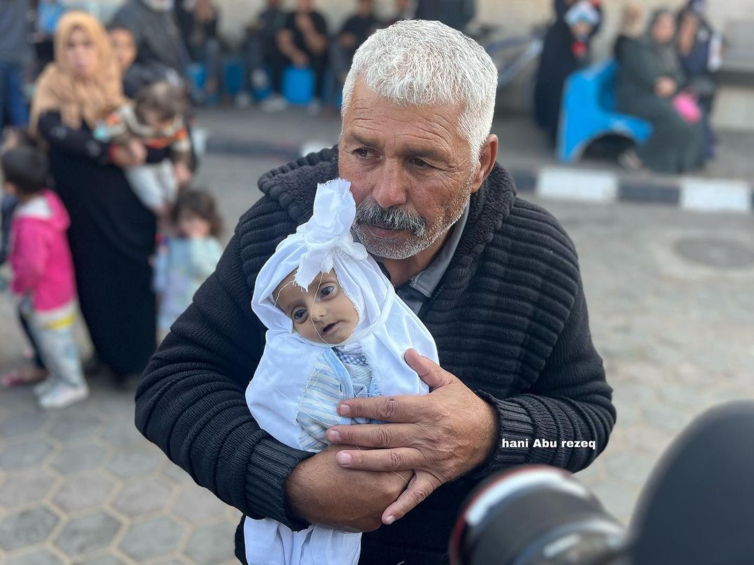 Zionist outlets, shills, and propagandists have the audacity to call this baby a fake doll...

What we see is nothing but a beautiful Shaheed.