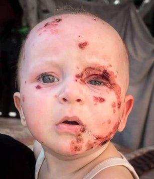 الحسابات المساندة لفلسطين يجب أن تتابع بعضها، يجب أن نتحول إلى مجتمع كبير فالمعركة مستمرة وطويلة على ما يبدوا !

أوصوا بالحسابات الداعمة لغزة والمقاومة وتابعوا بعضكم البعض وأعدوا القوائم وشاركوها ✌🇵🇸
"ولا تنسوا حظر الحسابات المتصهينة"
#غزه_تقاوم_وستنتصر
#طوفان_الأقصى