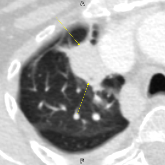 Gopal Punjabi tweet media