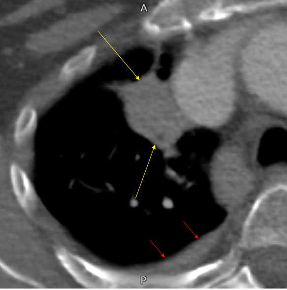 Gopal Punjabi tweet media