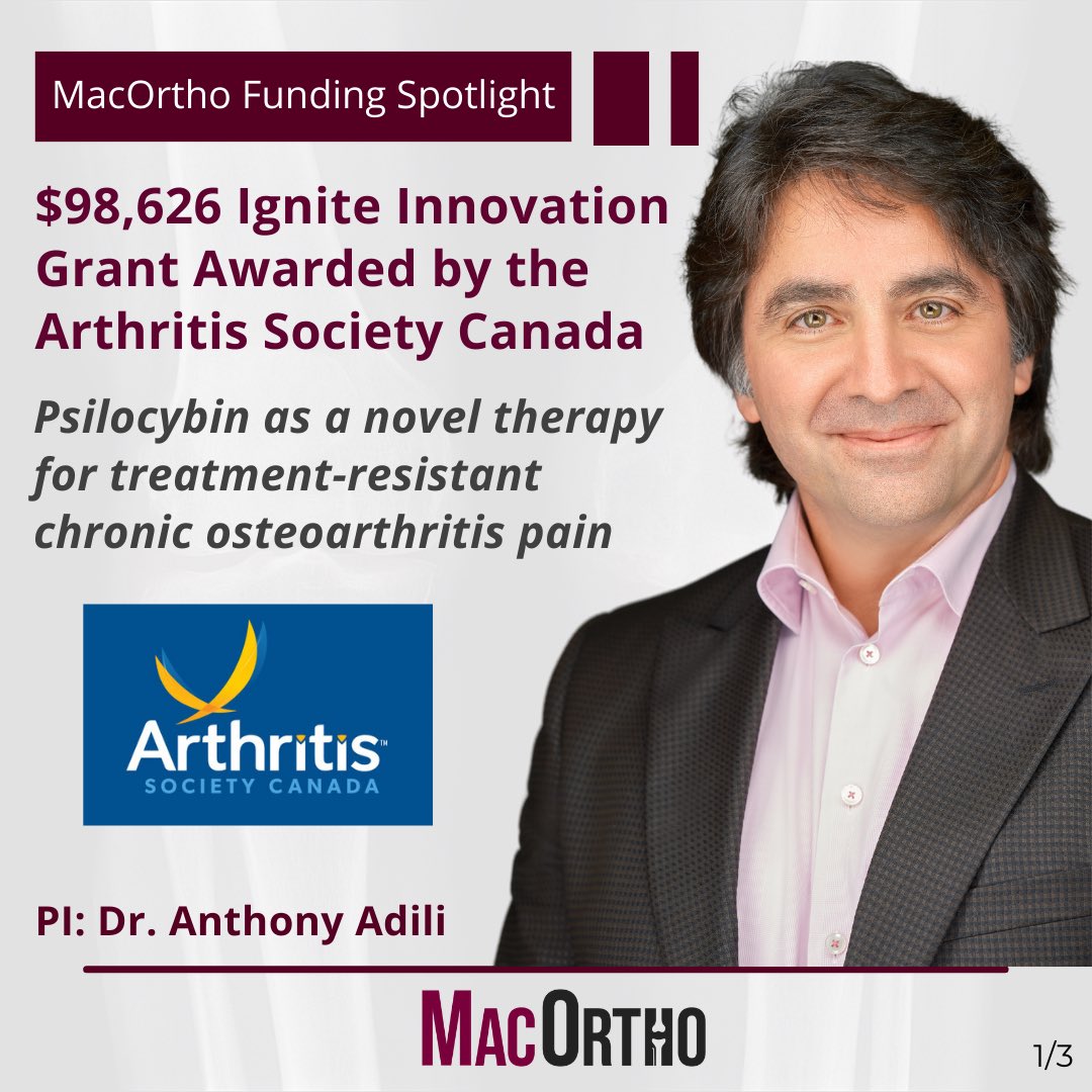 MacOrtho (@mac_ortho) on Twitter photo Congratulations to Dr. Anthony Adili who was awarded an Ignite Innovation Grant from the <a href="/ArthritisSoc/">Arthritis Society Canada</a> to support a new study titled Psilocybin as a novel therapy for treatment-resistant chronic osteoarthritis pain!
(1/3) Congratulations to Dr. Anthony Adili who was awarded an Ignite Innovation Grant from the <a href="/ArthritisSoc/">Arthritis Society Canada</a> to support a new study titled Psilocybin as a novel therapy for treatment-resistant chronic osteoarthritis pain!
(1/3)