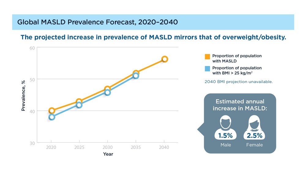 From our 2023 issue of Data Trends: MASLD/MASH and Weight Loss ow.ly/hKGi50Q9sVo