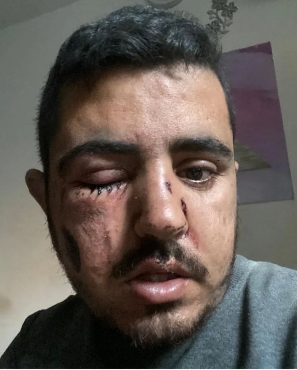 Hayat ne ağır. Geçen haftalarda anne babasını kaybetti, kendisi de yaralandı İsrail bombardımanında. Yine de devam etti işine. Yeni mesajlaşmıştık. Çektiği görüntü için tebrik etmiştim moral olsun diye. Bugün kendisinden acı haber geldi. Mekanın cennet olsun çalışkan kardeşim.