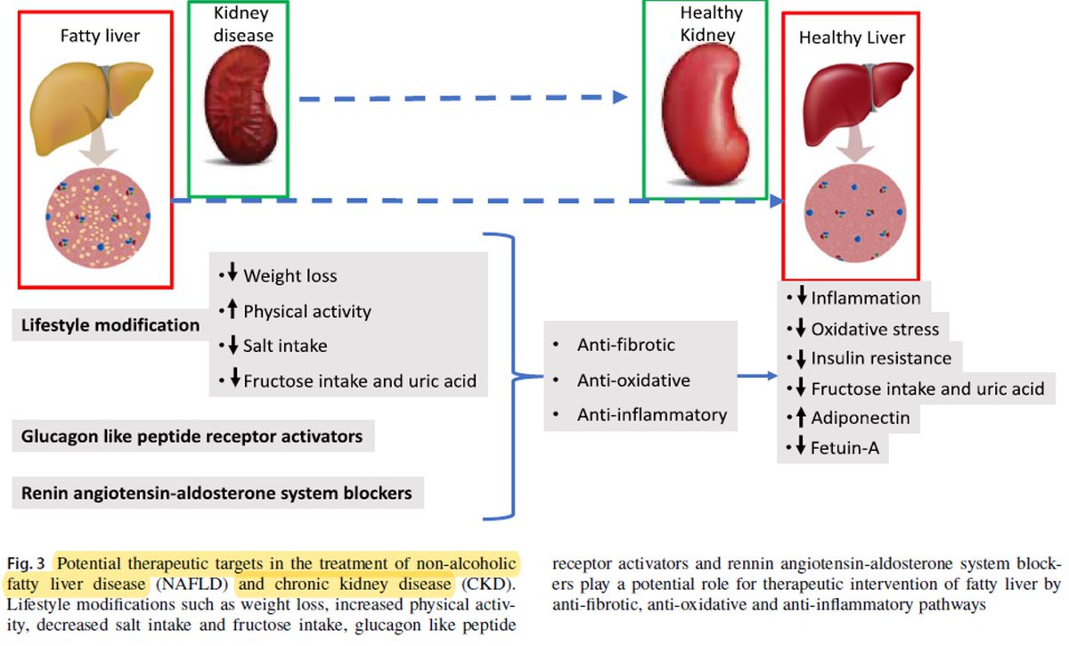 #Nephtwitter #Gastrotwitter
#Nephpearls
Hígado graso no alcohólico (NAFLD) y ERC 🫘

✔️Entre múltiples 'crosstalk' de órganos, hay un vínculo higado-riñon
✔️Se propone la relación entre NAFLD y ERC 👀👇🏼
✔️⬆️ riesgo de enfermedad CV🫀🧠

Kanbay et al. Journal of #Nephrology 2020