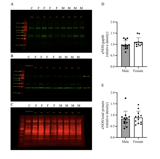 ajpheartcirc's tweet photo. #ArticlesInPress:  Myoendothelial feedback in mouse mesenteric resistance arteries is similar between the sexes, dependent on nitric oxide synthase, and independent of TPRV4
Looft-Wilson
https://t.co/YWnXR6rTEU
@williamandmary
#myoendothelialfeedback  #eNOS  #TRPV4 https://t.co/QCzQL6gK9f